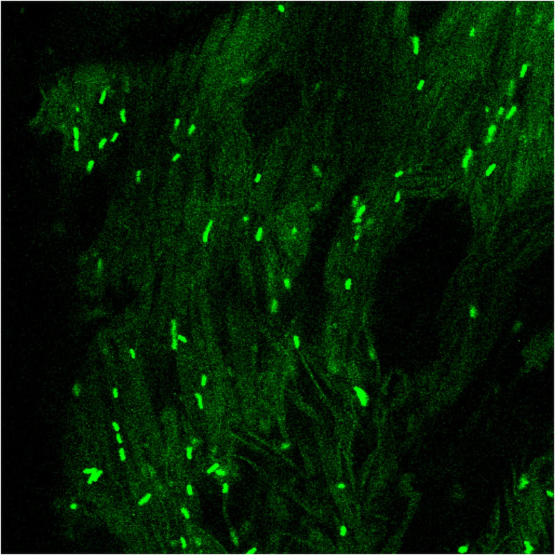Microscopy image of a fly gut with scattered clumps of rods of bacteria glowing green.